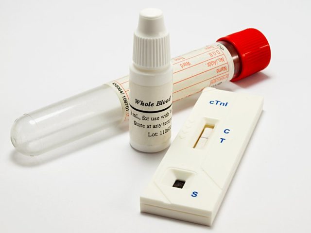 Тестовый набор для иммунохроматографического мгновенного обнаружения Тропонина I (cTnl) в крови и ее компонентах