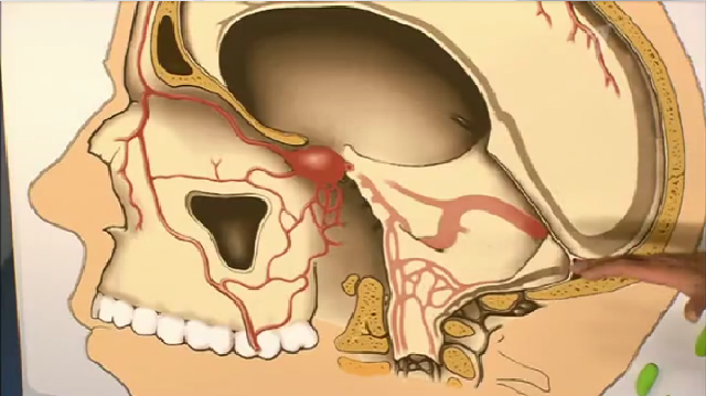 Расположенный в основании черепа по бокам от турецкого седла, этот парный синус участвует в осуществлении венозного оттока от глазниц и мозга 