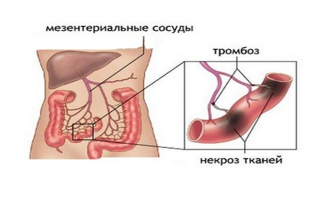Мезентерий – это совокупность брыжеечных тяжей, с помощью которых органы брюшной полости крепятся к брюшной стенке